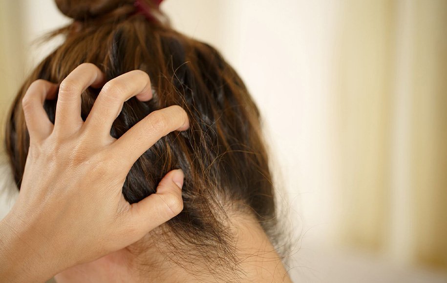 آیا کتوکونازول - یک ماده ضد شوره - در واقع به ریزش مو کمک می کند؟